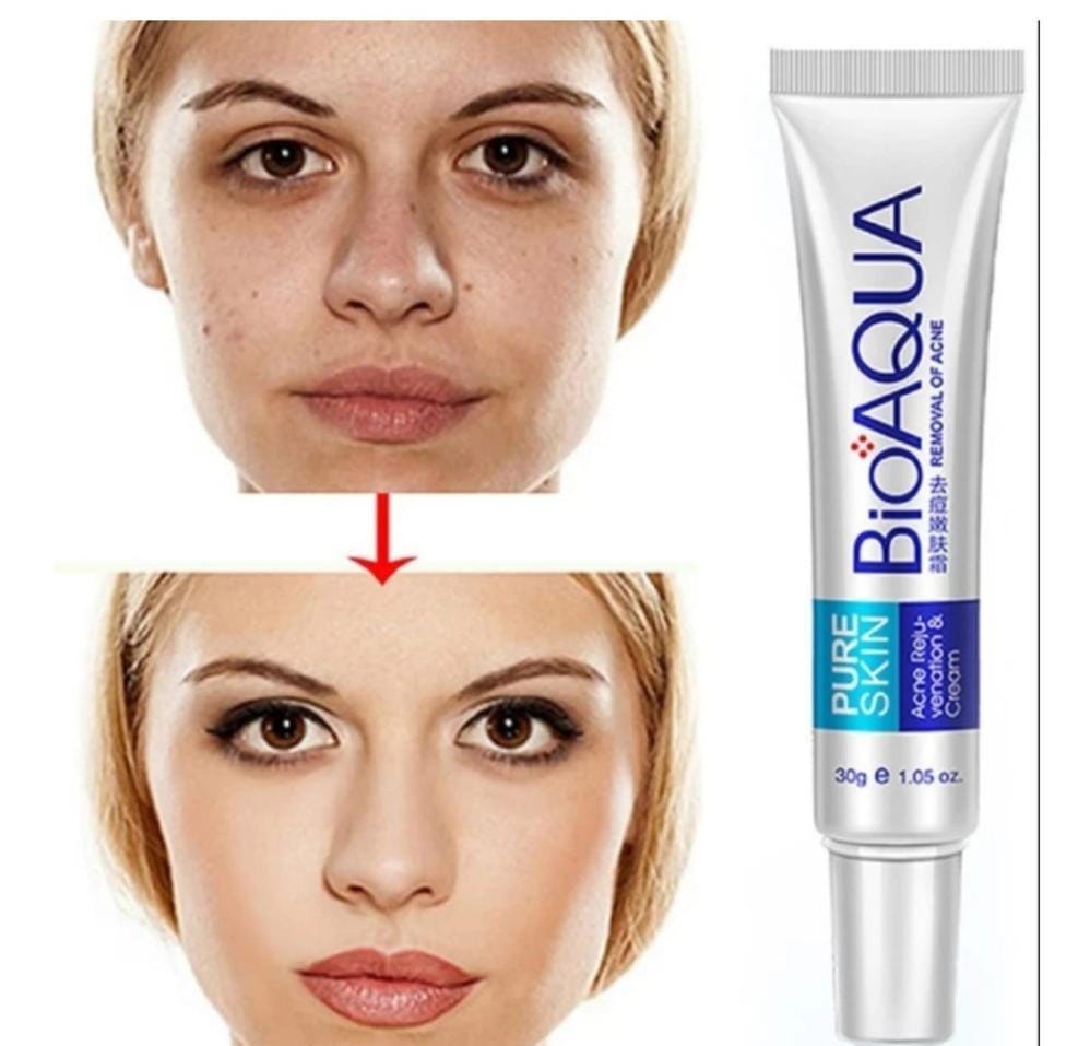 ClearSkin Acne Scar Removal Rejuvenation Cream - Smooth, Radiant Skin in Pakistan